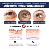 Eye Repair Essence Moisturizes, Hydrates And Lightened Eye Lines, Strengthens, Lifts And Smooths Fine Lines - V.I.P Digital Presence