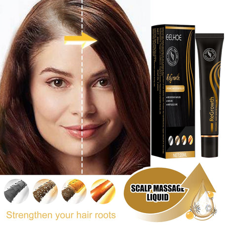 EELHOE Ball Bearing Dense Hair Essential Oil Thick Sparse Hair Bead Massage Scalp Care Fluid To Prevent The Loss Of Essential Oil - V.I.P Digital Presence