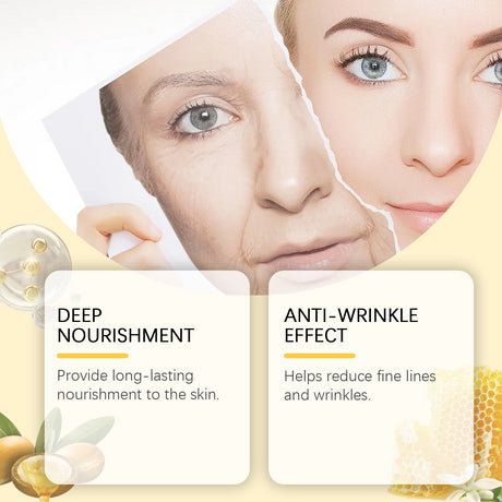 Propolis Eye Moisturizer, Moisturizing And Nourishing The Skin Around The Eyes, Firming, Lifting, Brightening And Anti-Wrinkle Care - V.I.P Digital Presence