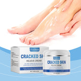 Hand And Foot Care Moisturizer Moisturizes Elbows, Heel Massage, Foot Care And Skin Care Foot Care Cream - V.I.P Digital Presence
