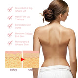 Acne Acne Ball, And Cleansing Skin Chest Back Acne Closing Skin Care - V.I.P Digital Presence