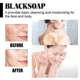 Shea Butter Black Soap, Repair Acne Pimple Acne Clear Pores Moisturize Smooth Skin Soap