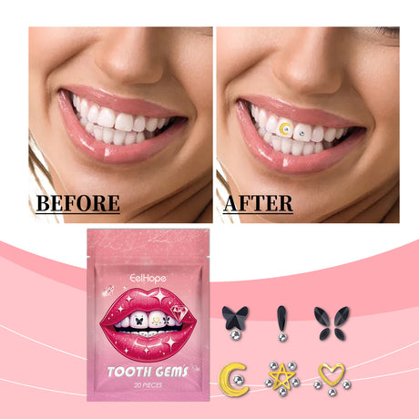 Crystal Dental Drill, Personality Sparkle Stylish Dental Accessories Enhance Smile Easily Use Decorative Dental Drill - V.I.P Digital Presence