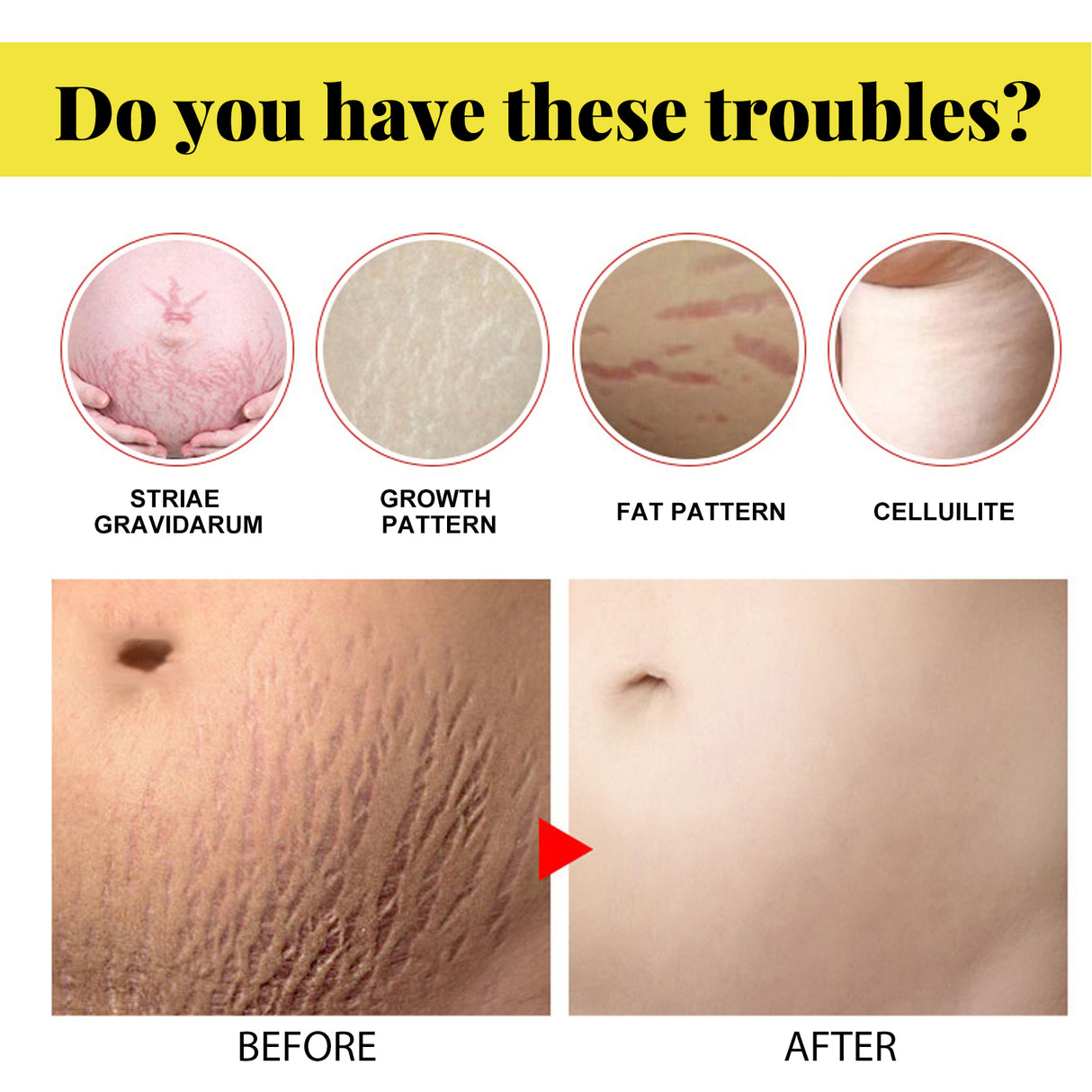 Skin Care Cream, Pregnant Women's Body Skin Gentle Repair Daily Care Moisturizing Moisturizer - V.I.P Digital Presence