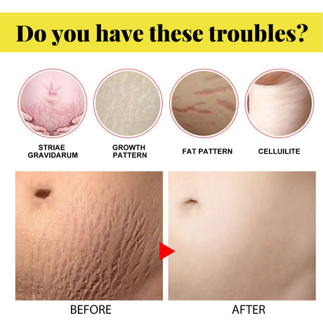 Skin Care Cream, Pregnant Women's Body Skin Gentle Repair Daily Care Moisturizing Moisturizer - V.I.P Digital Presence