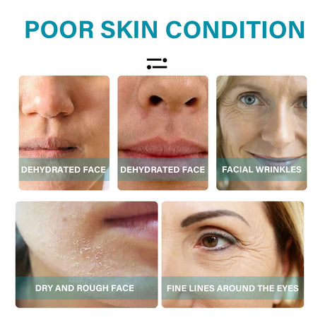 Anti-Wrinkle Ampere Essence, Skin Care Firming Anti-aging Lightening lines Essence - V.I.P Digital Presence