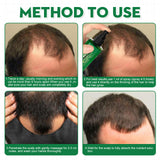 Men's Hair Serum For Hair Stabilization Nourishes And Nourishes Your Hairline - V.I.P Digital Presence