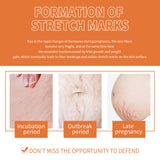 Pregnancy Massage Oil, Repair Pregnant Women Prenatal And Postpartum Stretch Mark Skin Care Massage Oil - V.I.P Digital Presence