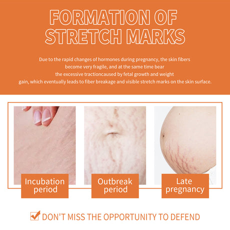 Pregnancy Massage Oil, Repair Pregnant Women Prenatal And Postpartum Stretch Mark Skin Care Massage Oil - V.I.P Digital Presence