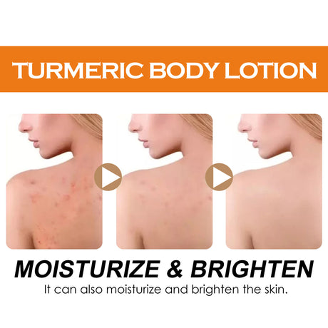 Turmeric Body Lotion, Moisturizing And Moisturizing Whitening Skin Refreshing And Brightening Winter Skin Care Body Lotion - V.I.P Digital Presence