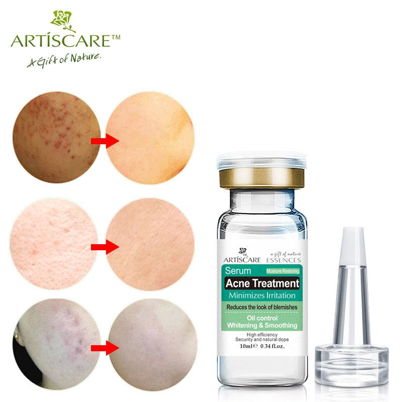 ARTISARE Acne Original Liquid essence - V.I.P Digital Presence