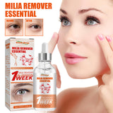 Milia Remover Essential, Fade Eye Granules Firming And Lifting Fine Lines Eye Serum - V.I.P Digital Presence