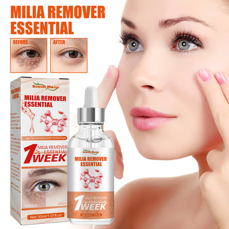 Milia Remover Essential, Fade Eye Granules Firming And Lifting Fine Lines Eye Serum - V.I.P Digital Presence