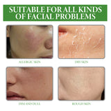 Aloe Vera Serum, Repair Dry Skin Moisturizes And Hydrates To Lighten Pimples And Seal Delicate Pores - V.I.P Digital Presence