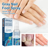 Nail Care Spray Gently Cleans Foot Nails Moisturizing And Brightening Nail Care Spray - V.I.P Digital Presence