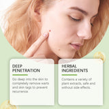 Comfrey Keryou Essence, Smoothing Body Skin Repair And Toning Meat Granules Moisturizing Essence - V.I.P Digital Presence