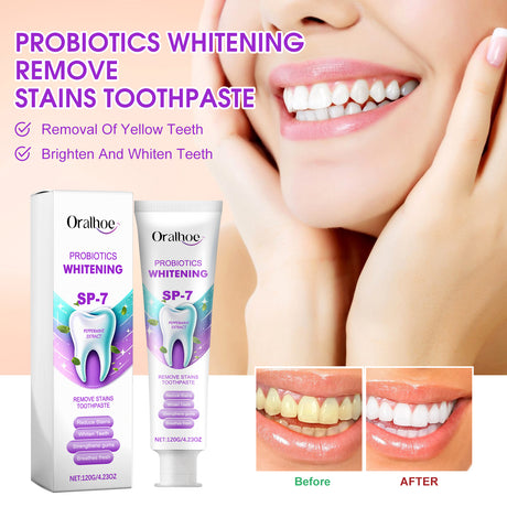 Probiotics Whitening Remove Stains Toothpaste, Dental Care Cleaning Oral Odor Toothstains Tartar Beautifying Teeth Whitening - V.I.P Digital Presence