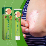 Herbal Skin Care Cream Gently Nourishes The Skin Of Hands And Feet And Smoothes The Skin