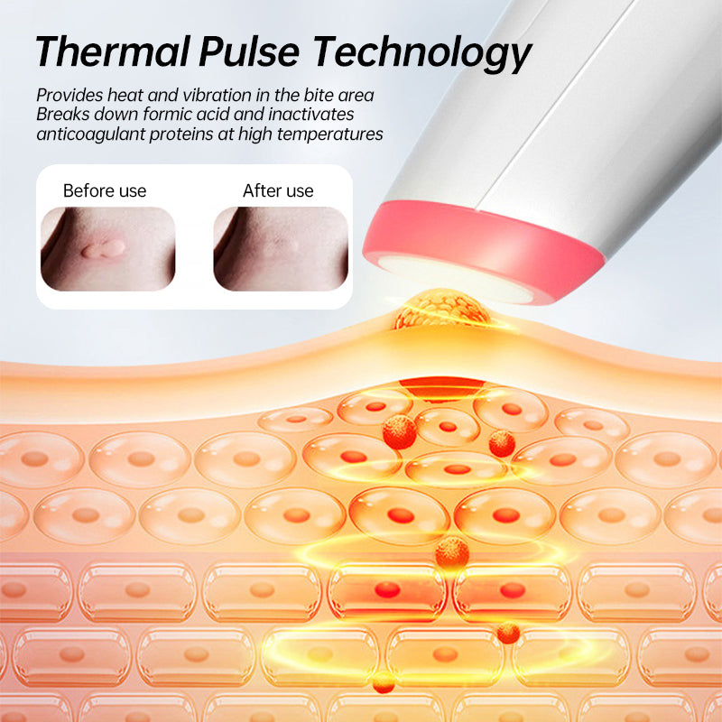 Portable anti-itch pen for insect/mosquito bites, natural & rechargeable, suitable for all ages. - V.I.P Digital Presence