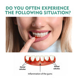 Oral Relief Spray To Relieve Aphthous Sores Bubbling Periodontal Pain Oral Care Spray - V.I.P Digital Presence