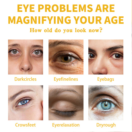 Vitamin E Eye Cream, Lightened Dark Circles Crow's Feet, Firmed And Moisturized Eye Cream - V.I.P Digital Presence