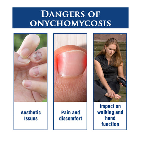 Biological Repair Pencil, Hand, Foot And Nail Care Thickening Repair Soft Nail Insert Nail Bright Nail Nail Pen - V.I.P Digital Presence