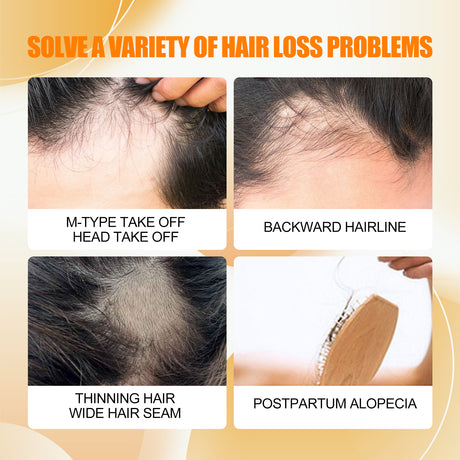 Hair Growth And Care Oil, Repair The Hair Dry Deep Moisturizing Smooth Hair Knot Not Dense Hair Oil - V.I.P Digital Presence