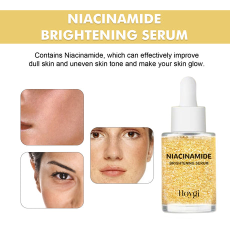 HOYGI Niacinamide Brightening Serum, Lightening Spots And Fine Lines Brightening Skin Hydrating Moisturizing Facial Treatment - V.I.P Digital Presence