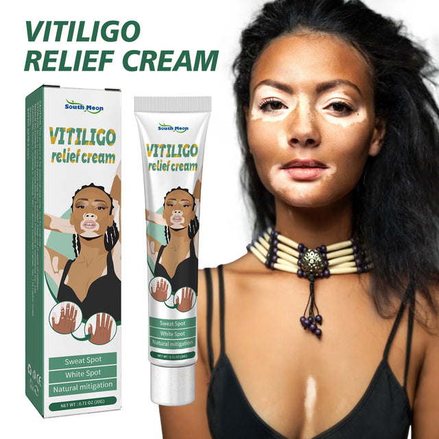 Vitiligo Relief Cream, Repair White Spots Flower Spots Skin Topical Care Ointment - V.I.P Digital Presence