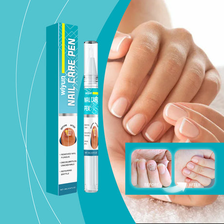 Nail Repair Pen, Foot Hand Moisturizing Care Nail Face Guard Fingertip Beauty Care Pen - V.I.P Digital Presence