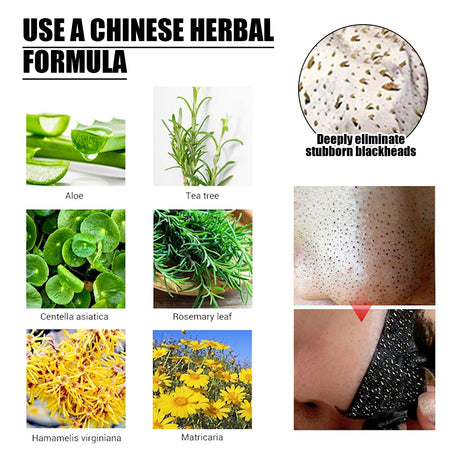 Blackhead Removal Mask, Peel Off Remove Blackhead Activated Carbon Cleansing Face Mask - V.I.P Digital Presence