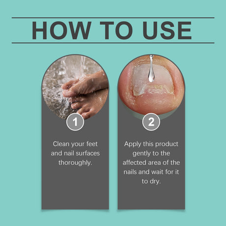 Nail Repair Oil Clean, Nourish And Gently Repair Hands, Feet And Nails Glossy Foot Nail Repair Oil - V.I.P Digital Presence