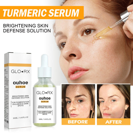 Turmeric Whitening Spot Serum, Lighten Freckle Spots Brightening Skin Hydrating Serum - V.I.P Digital Presence