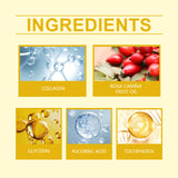 Rose Hip Oil Nourishes And Moisturizes Fine Lines On The Face And Leaves Skin Soft, Smooth And Firm