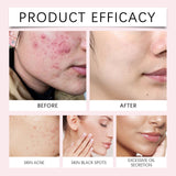 EELHOE Turmeric Kojic Acid Cleansing Pads Exfoliating Pads Facial Sponges For Cleansing Exfoliating Daily Cleansing Skin Care (40 PCS) - V.I.P Digital Presence