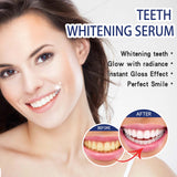 Teeth Whitening Serum, Remove Stains Yellow Dirt Deep Cleaning Whitening Essence - V.I.P Digital Presence