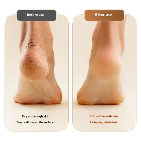 Electric foot grinder for removing dead skin and calluses, foot repair device for grinding stone heels, automatic home use foot - V.I.P Digital Presence