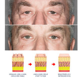 Men's Retinol Eye Cream, Gentle Nourishing Eye Skin Moisturizing And Firming Apply Eye Cream - V.I.P Digital Presence