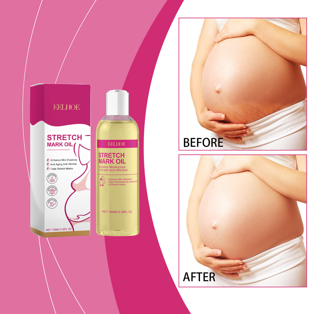 Skin Care Oil, Gentle, Nourishing And Improving Skin Care Oil For Postpartum Mothers - V.I.P Digital Presence