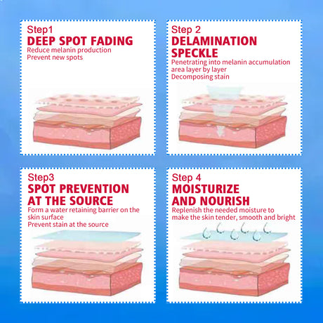 Blemish Cream, Whitening Skin Reduce Melanin Melasma Stains And Hydrating Cream - V.I.P Digital Presence