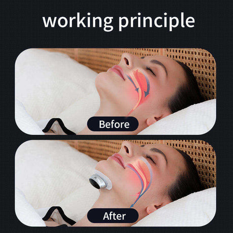 Better Sleep Apnea Aid Treatment Tool Breathing Corrector Smart Snoring Stopper Anti Snore Devices - V.I.P Digital Presence