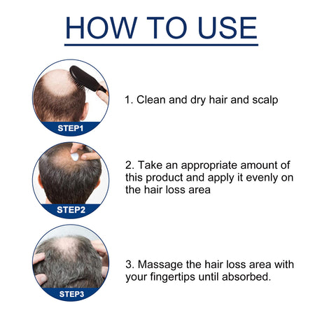Alopecias Hair Growth Cream, Protect Hair Follicles Strong Moisturizing Thick Hairline Hair - V.I.P Digital Presence