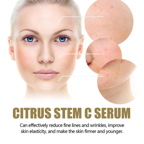 Citrus Stem C Serum, Reduce Wrinkles Improve Skin Elasticity Firming And Lifting Anti-Aging Serum - V.I.P Digital Presence