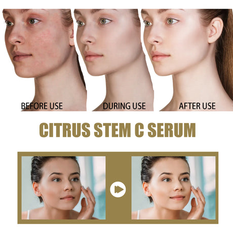 Citrus Stem C Serum, Reduce Wrinkles Improve Skin Elasticity Firming And Lifting Anti-Aging Serum - V.I.P Digital Presence