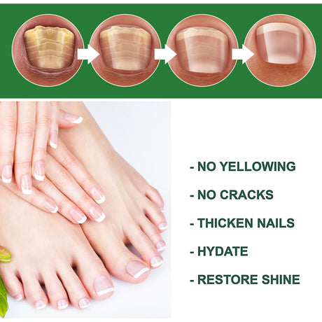 Nail Care Liquid Hand and Foot Nail Care Liquid Daily Cleaning Nail Brightness Soft Nail Moisturizing Nail - V.I.P Digital Presence