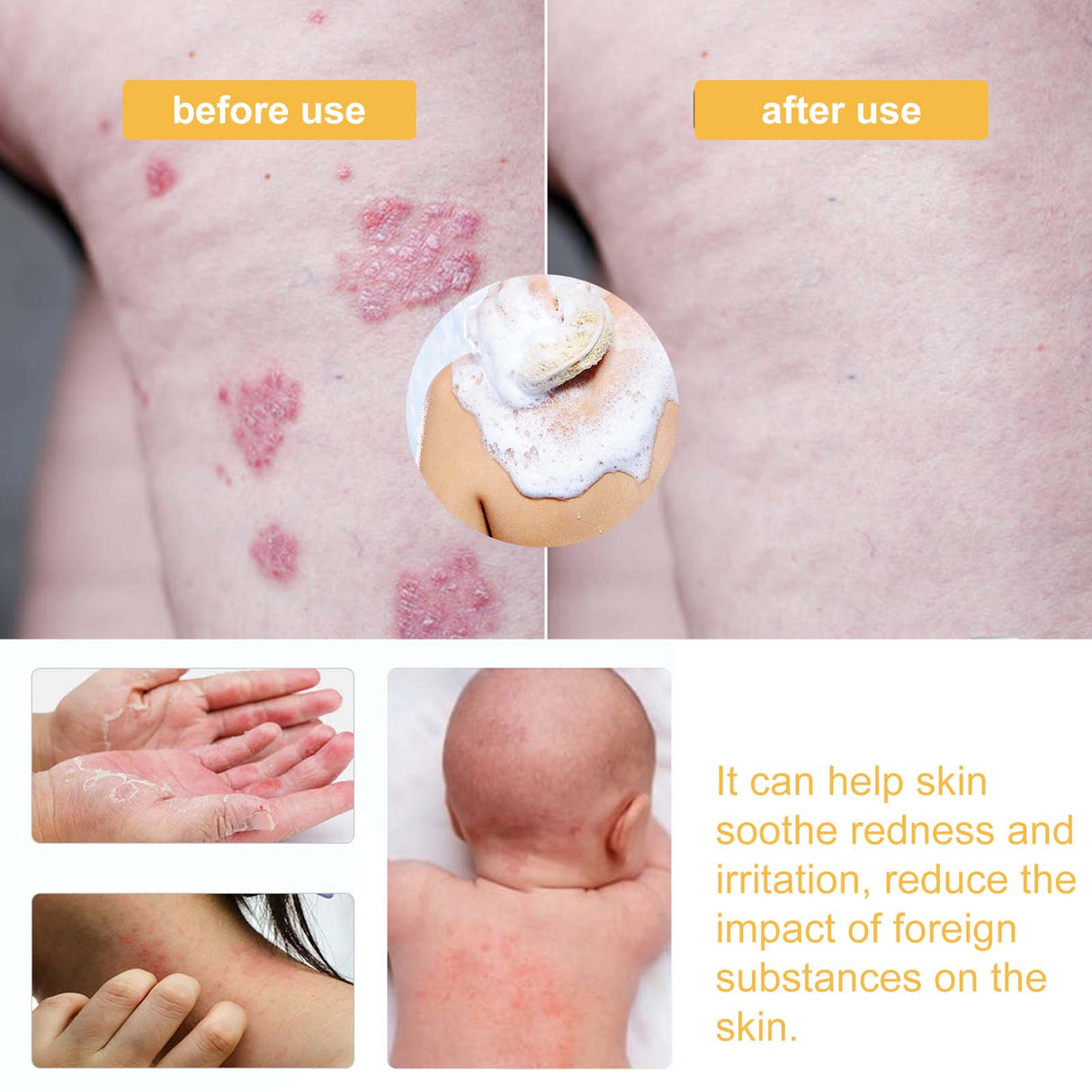 Honey Shower Gel Deeply Cleanses, Moisturizes, Rejuvenates And Relieves Red, Dry And Itchy Skin