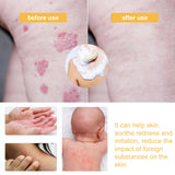 Honey Shower Gel Deeply Cleanses, Moisturizes, Rejuvenates And Relieves Red, Dry And Itchy Skin