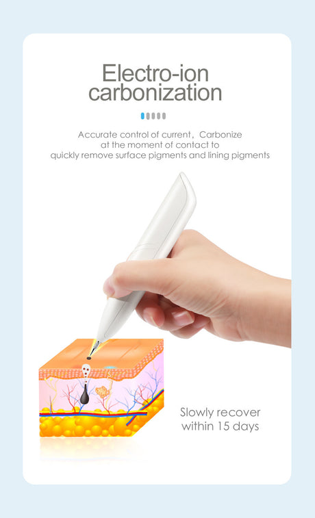 Mini USB mole removal pen, spot removal and wrinkle removal pen, ion carbonization pen, plug-in type - V.I.P Digital Presence