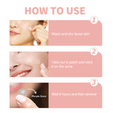 Acne Patch, Repair Acne Pimples Acne Invisible Concealer Breathable Acne Patch - V.I.P Digital Presence