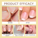 Jojoba Oil For Nails, Nail Care Anti-Barb Edge Oil Softening Nourishing Base Oil For Nail Protectors - V.I.P Digital Presence